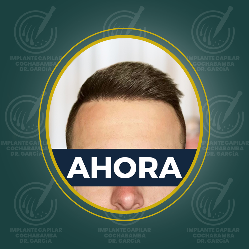 undefined - Después