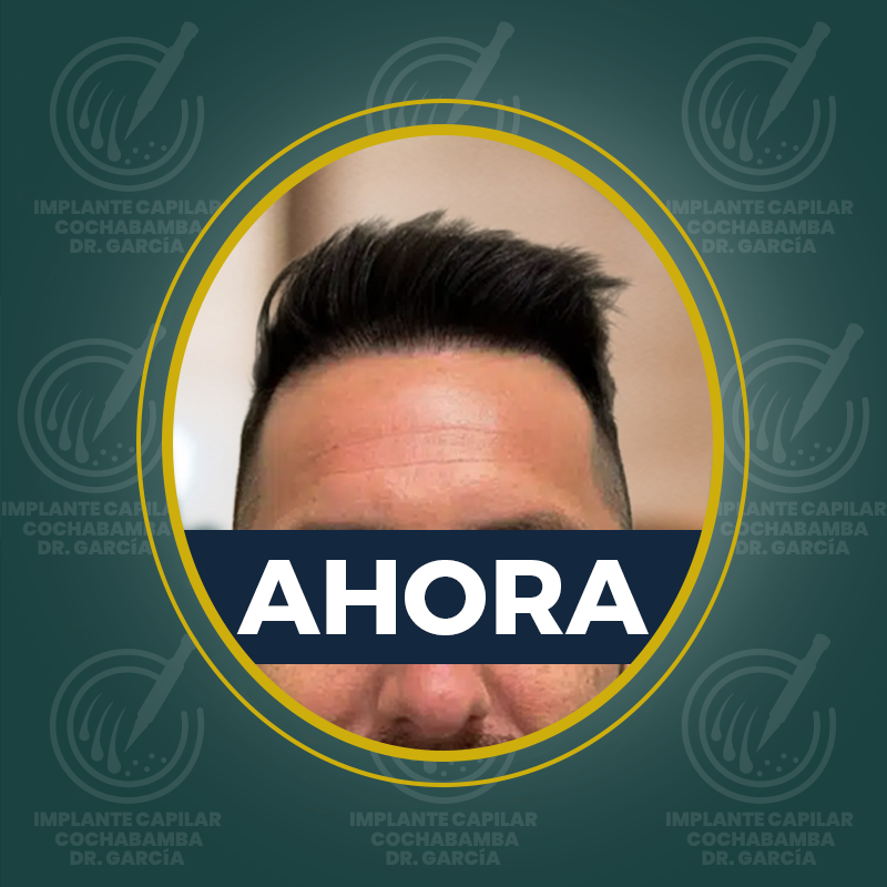 undefined - Después