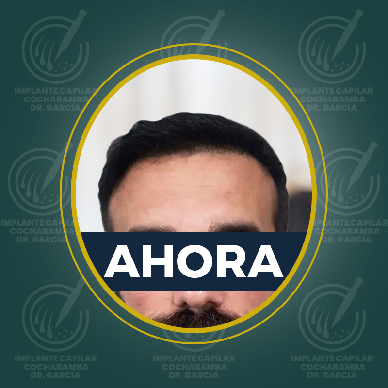 undefined - Después