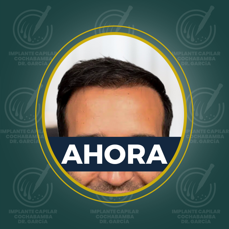 undefined - Después