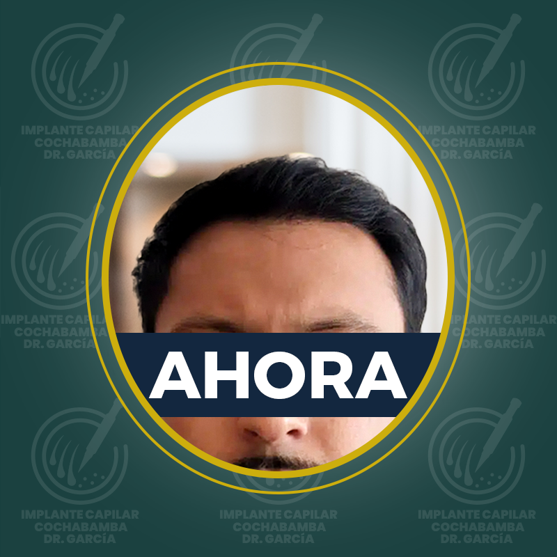 undefined - Después