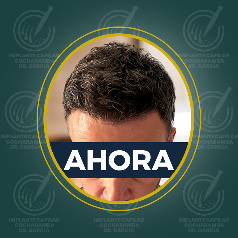 undefined - Después