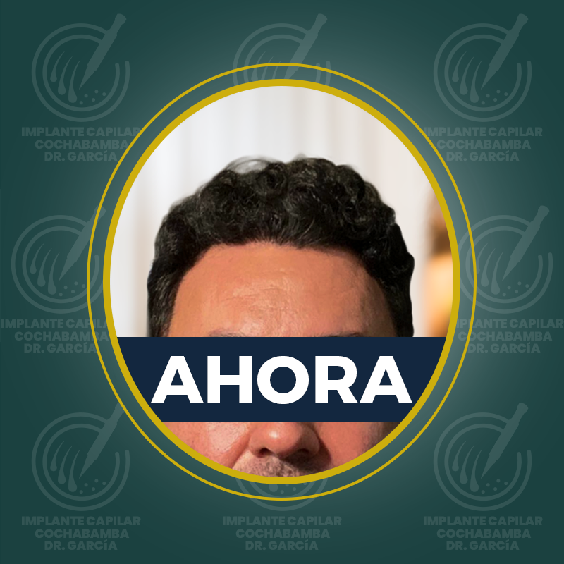 undefined - Después