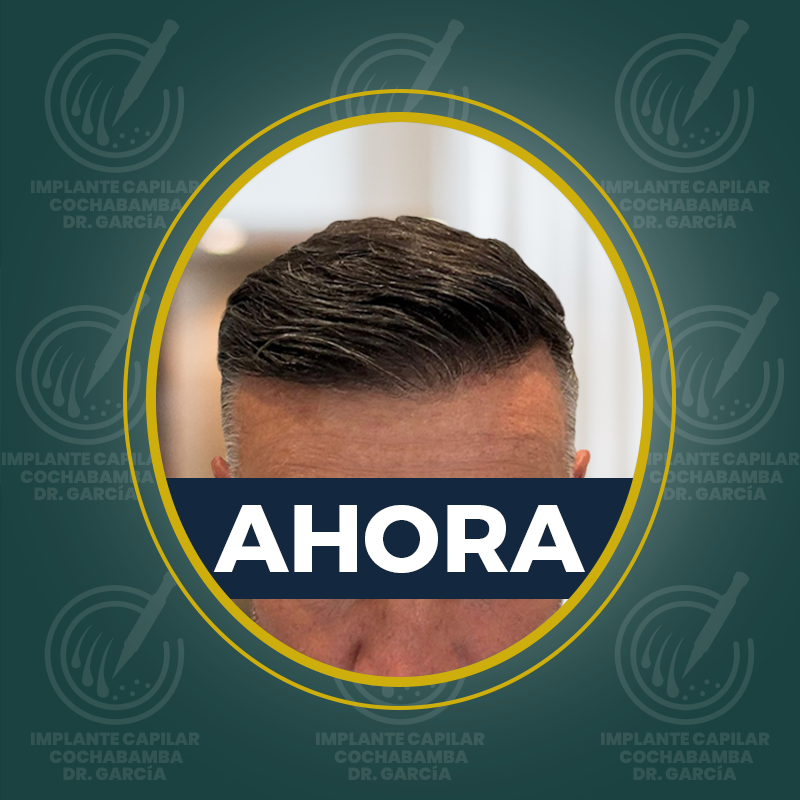 undefined - Después