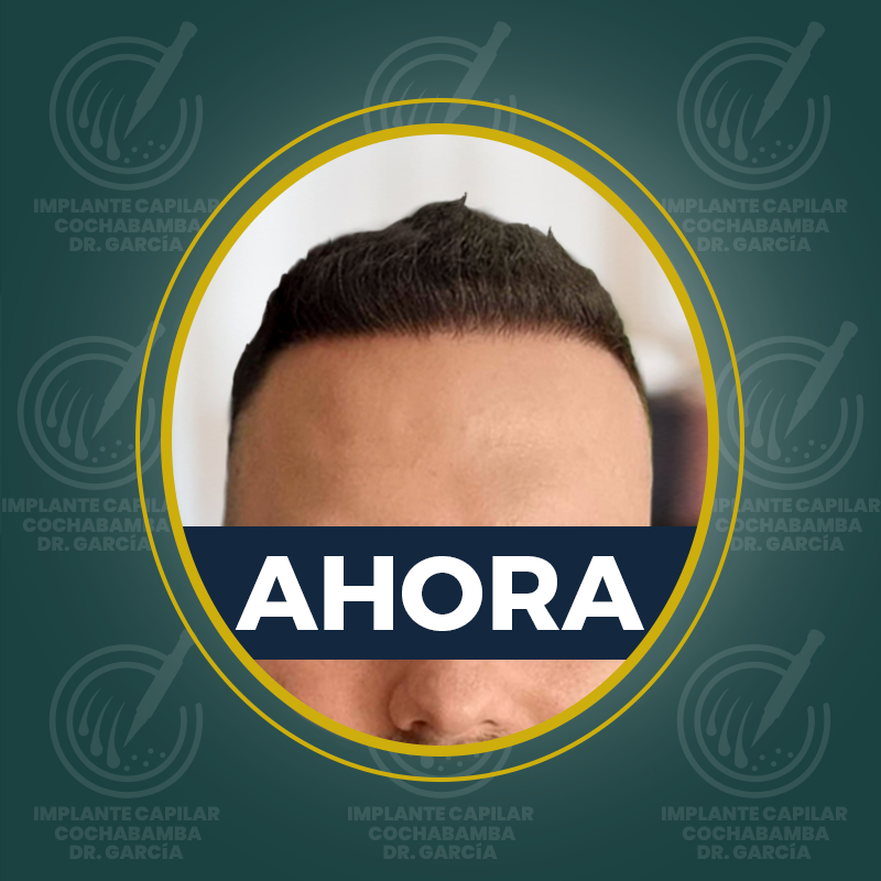 undefined - Después