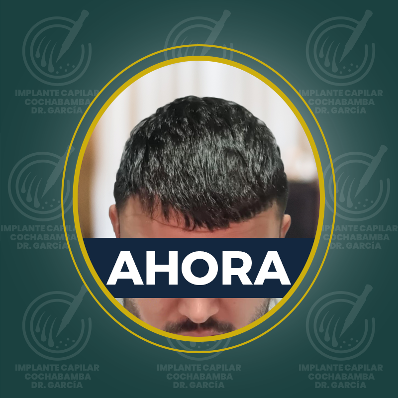 undefined - Después