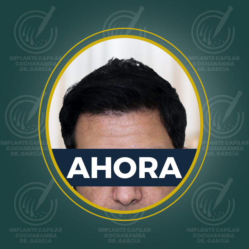 undefined - Después