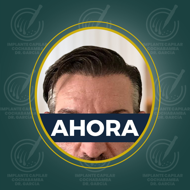 undefined - Después