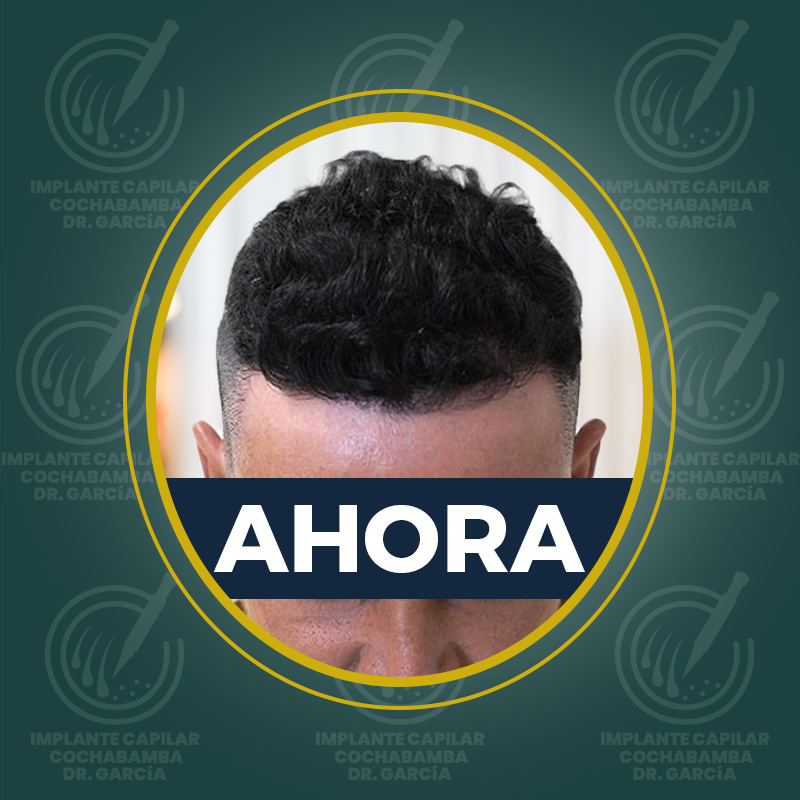 undefined - Después