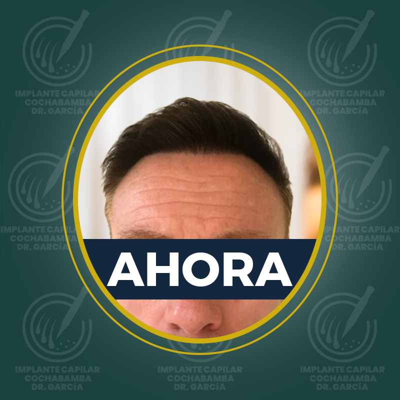 undefined - Después