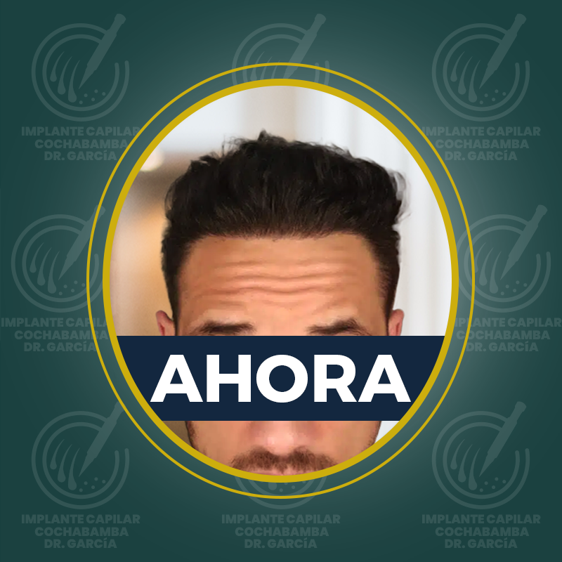 undefined - Después