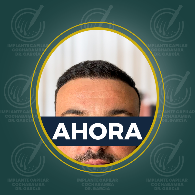 undefined - Después